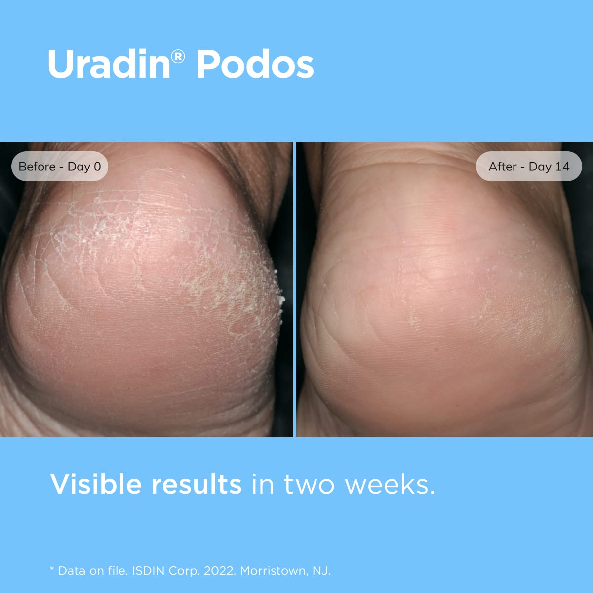 ISDIN Uradin Podos Gel Oil – Hydrating Foot Care with 10% Urea