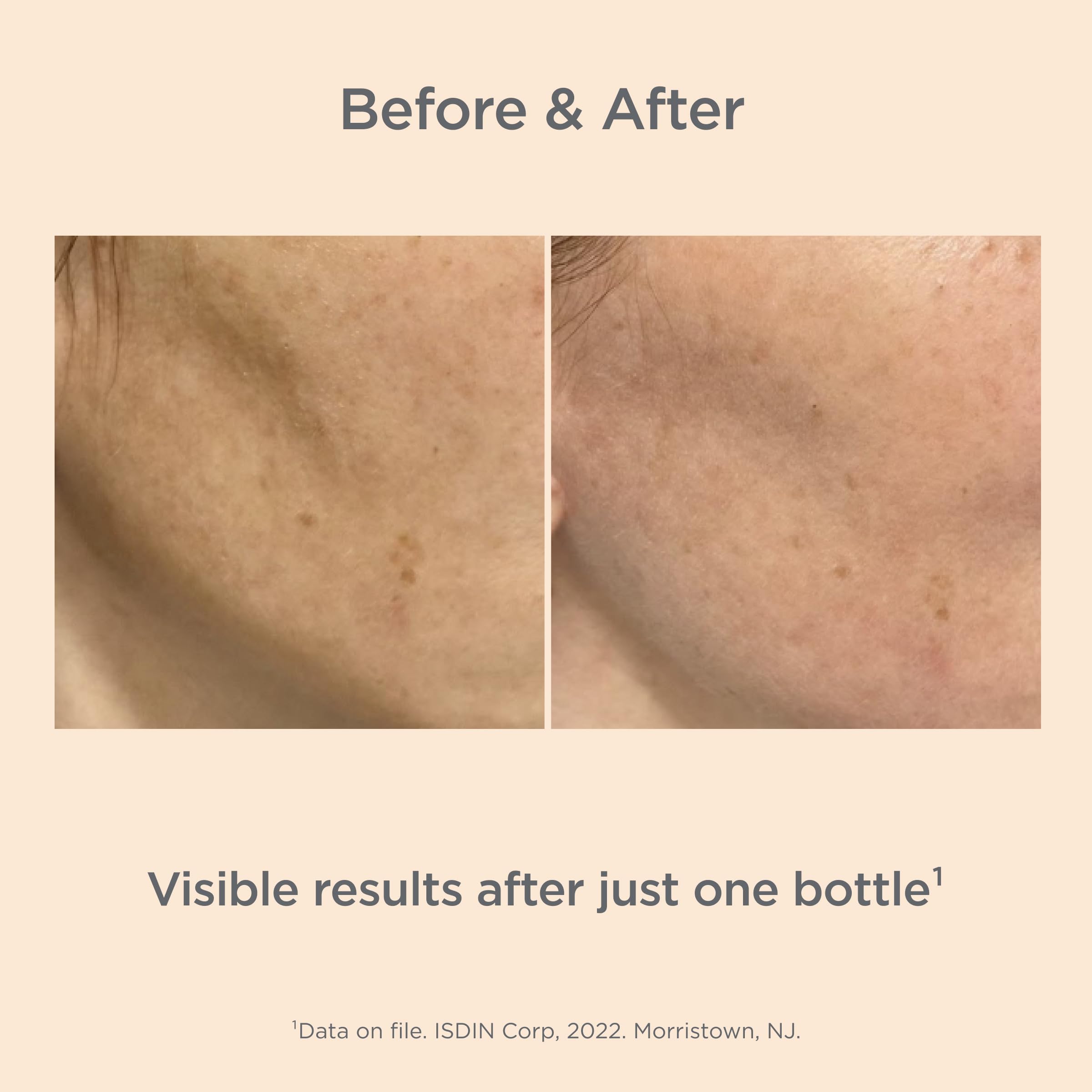 ISDIN Melaclear Advanced Dark Spot Corrector with Niacinamide – 1.7 fl oz