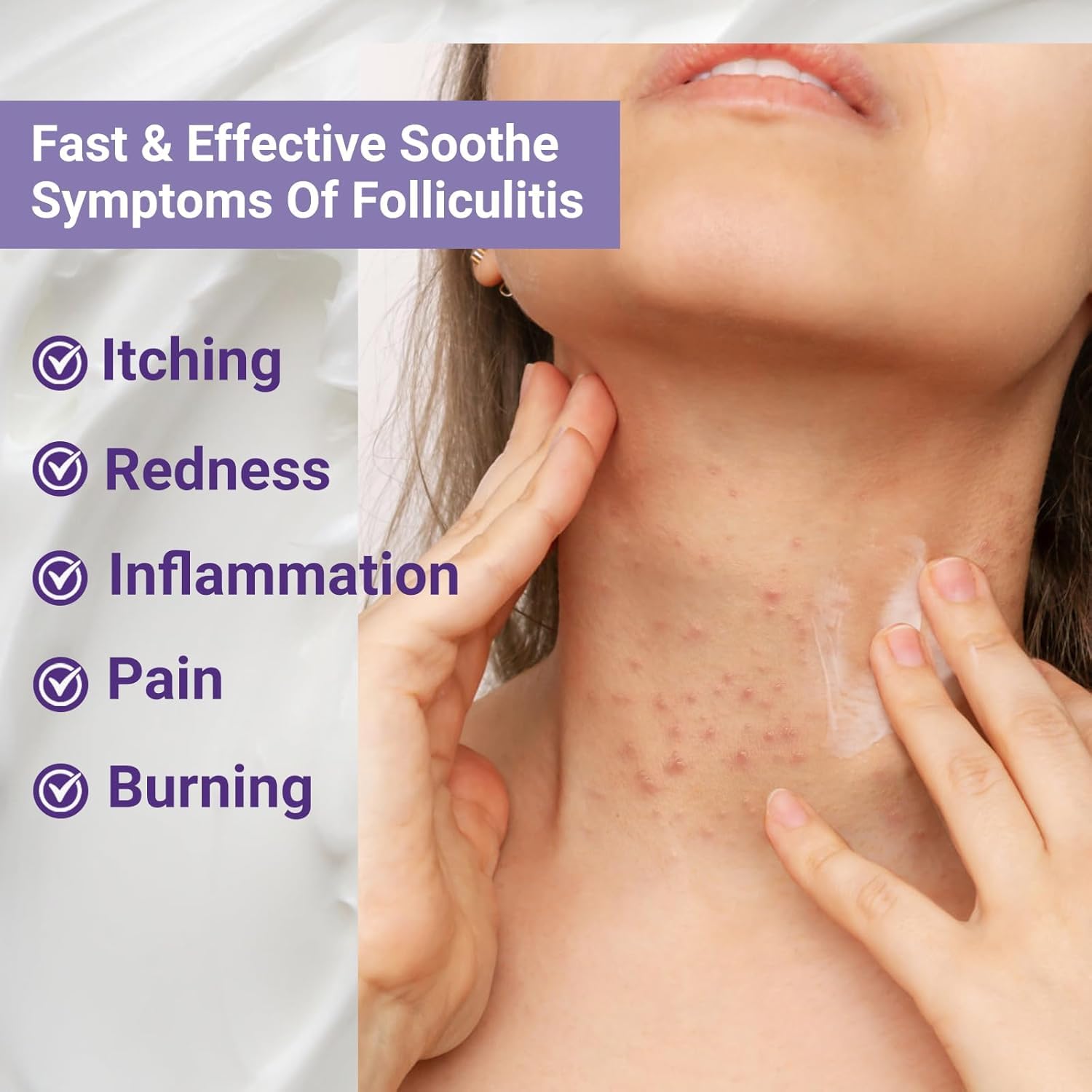 ishancare Folliculitis Treatment Cream – Natural Relief for Itching, Redness & Inflammation | 3.53 Oz