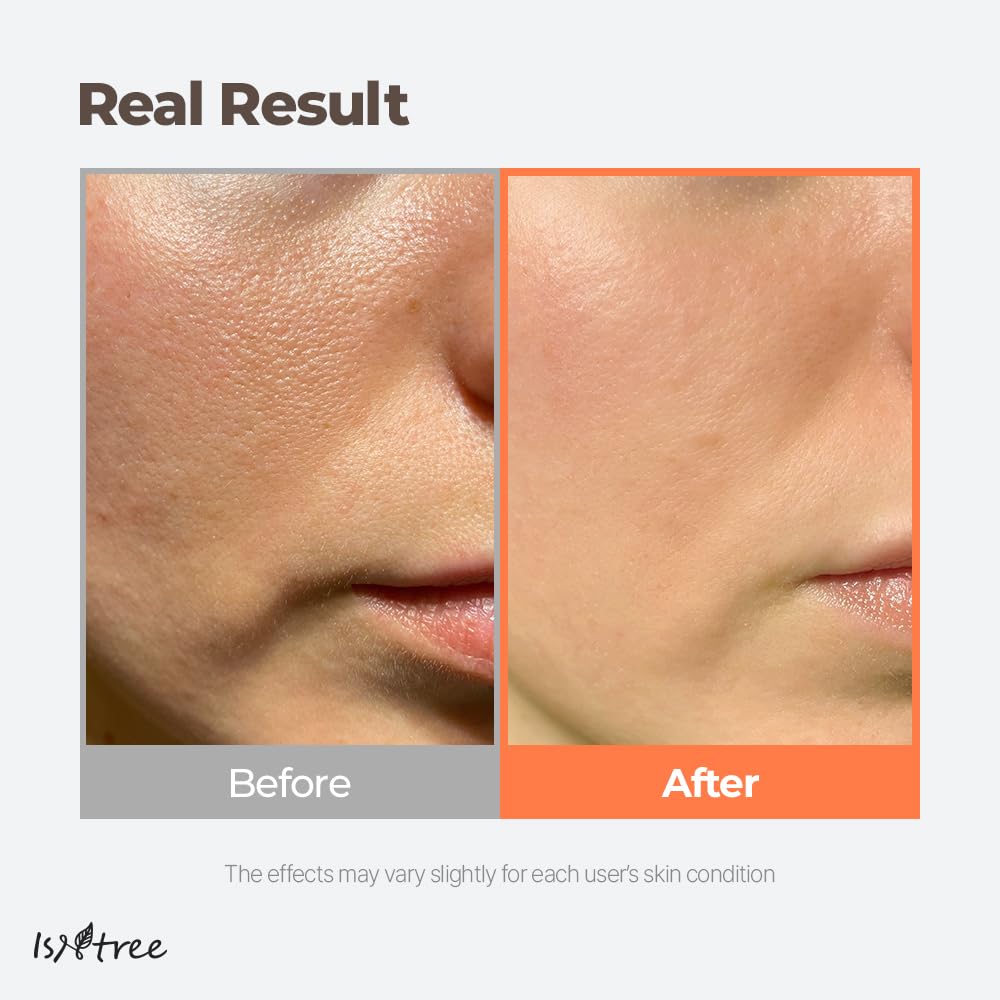 ISNTREE Green Tea Fresh Toner 200ml – Hydrating & Oil Control for Oily Skin