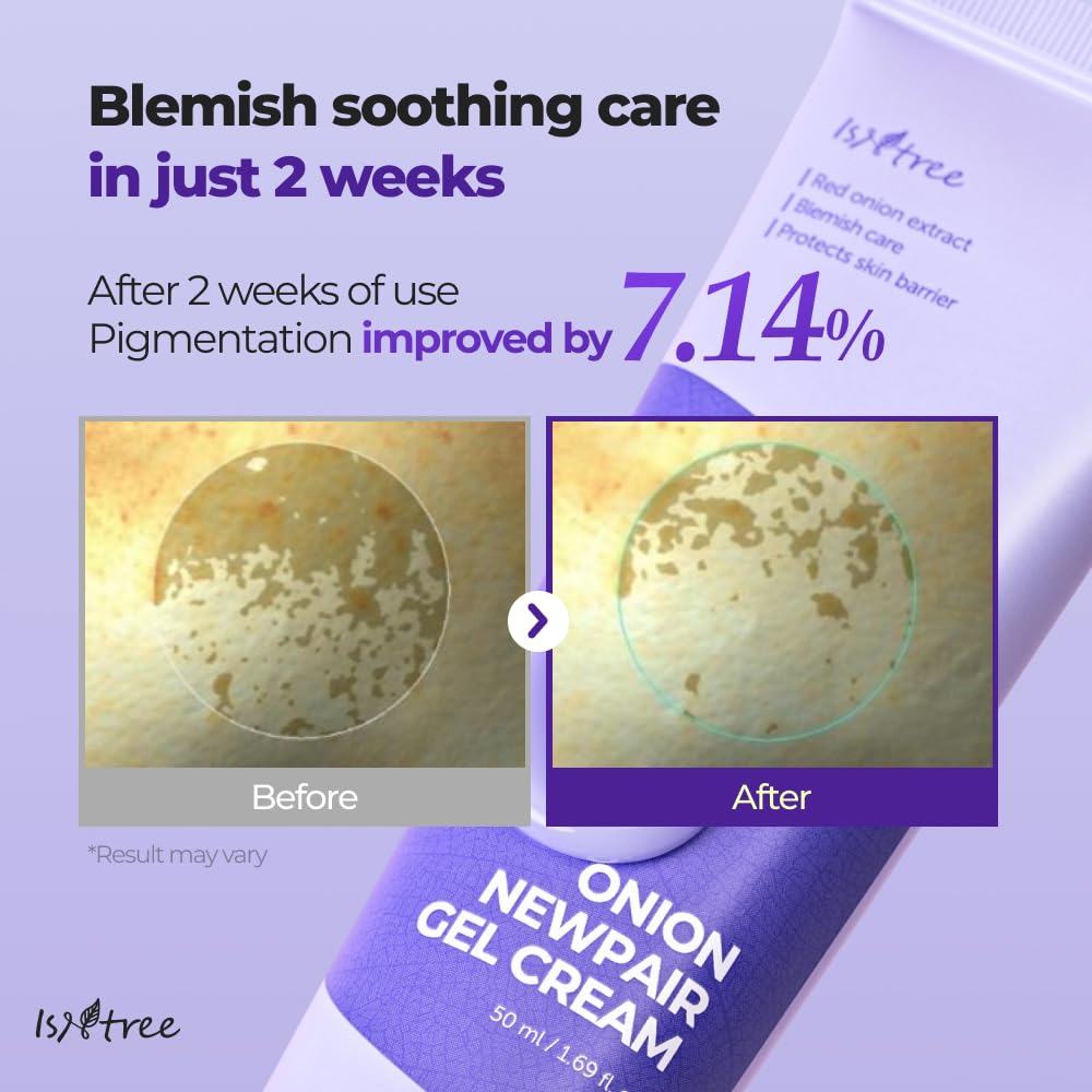 IsNtree Onion Newpair Gel Cream 50ml | 3-Layer Hyaluronic Acid Hydration | 71% Red Onion Extract | Non-Sticky Moisturizer