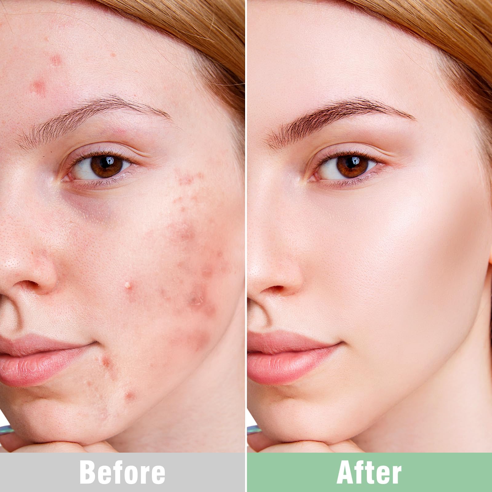 ISTON Overnight Hydrogel Mask for All Skin Types | Deep Hydration & Barrier Support