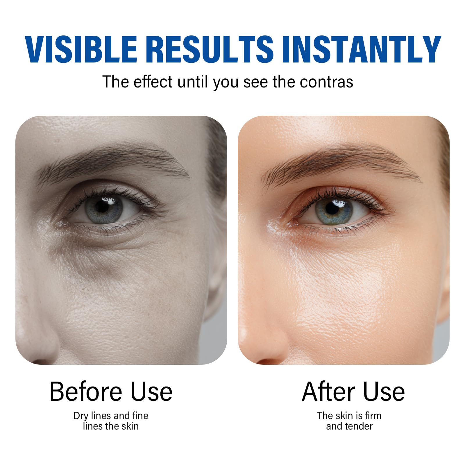 ITECFREELY Instant Eye Tightener-0205 – Quick Lift for Under-Eye Care