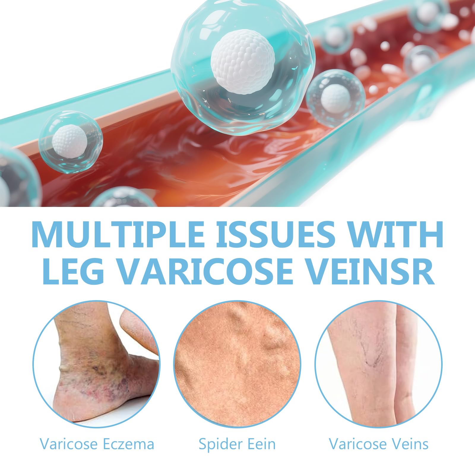 ITECFREELY Varicose Veins Cream – Improve Circulation & Leg Comfort