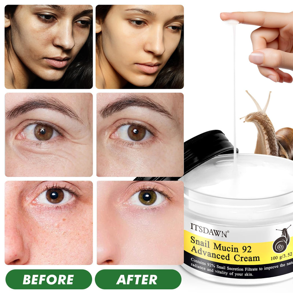 ITSDAWN 2 Pack Snail Mucin 92% Cream 100g – Hydrating Moisturizer for Dry & Sensitive Skin
