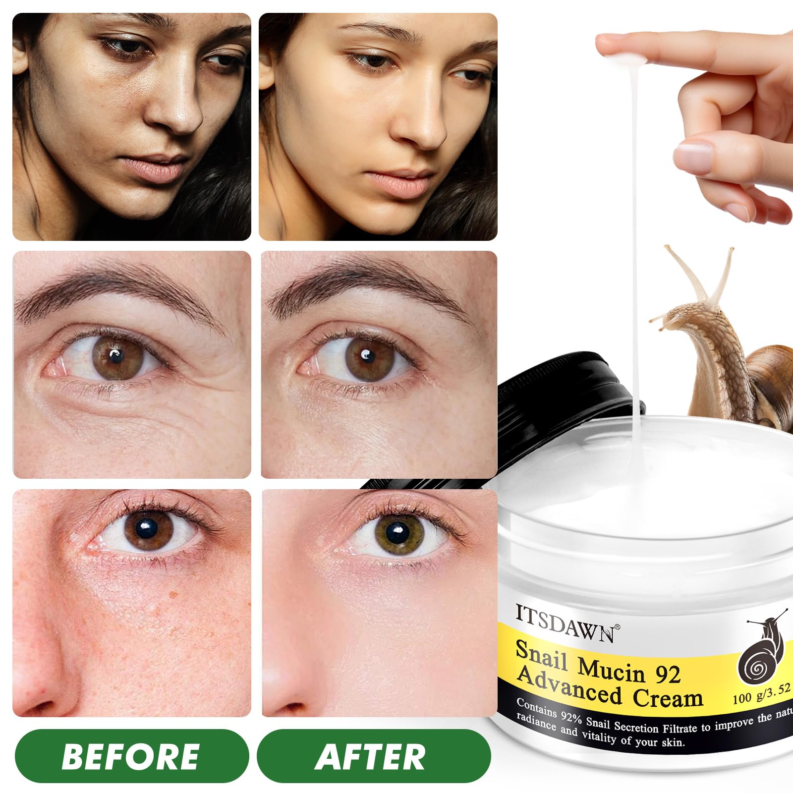ITSDAWN 2 Pack Snail Mucin 92% Cream 100g – Hydrating Moisturizer for Dry & Sensitive Skin