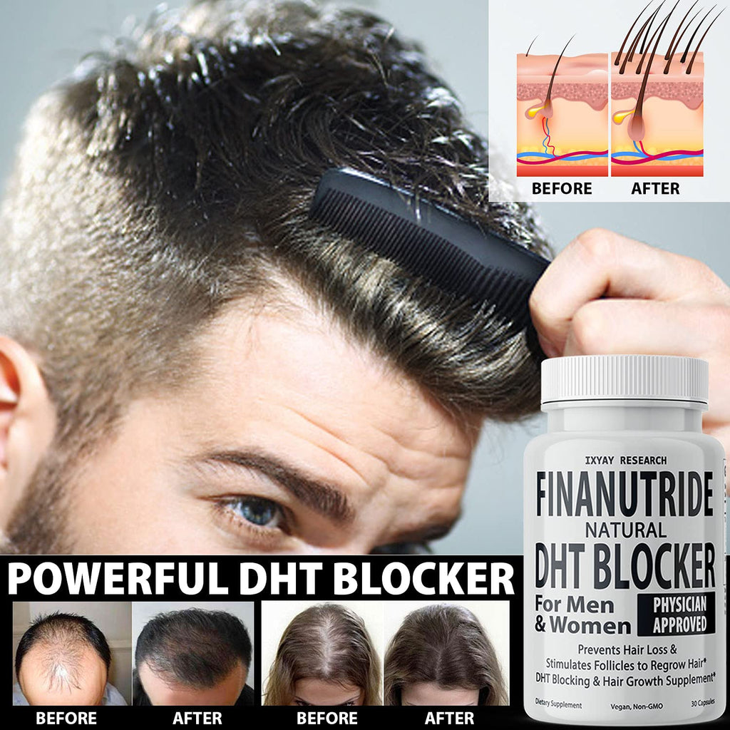 Finanutride | Natural DHT Blocker & Hair Growth Capsules | IXYAY RESEARCH
