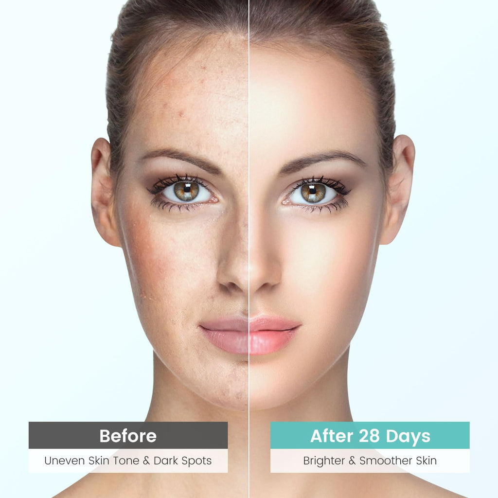 Jacrynth Dark Spot Remover Serum with 360° Roller — Acne Scars & Uneven Tone, 0.7 fl oz