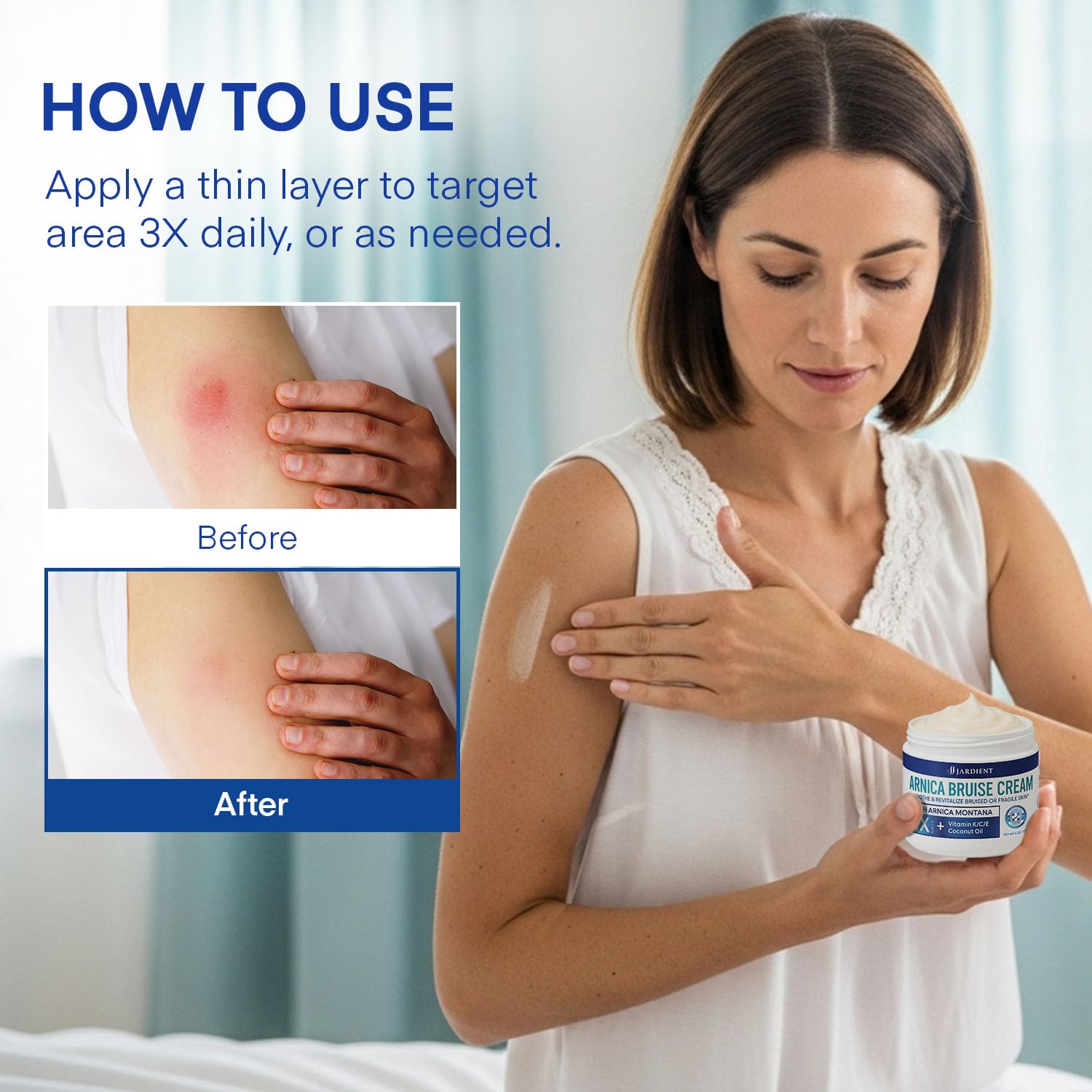 Jardient Arnica Bruise Cream Extra-Strength – Fast-Acting for Bruises on Thin Skin (4 oz)