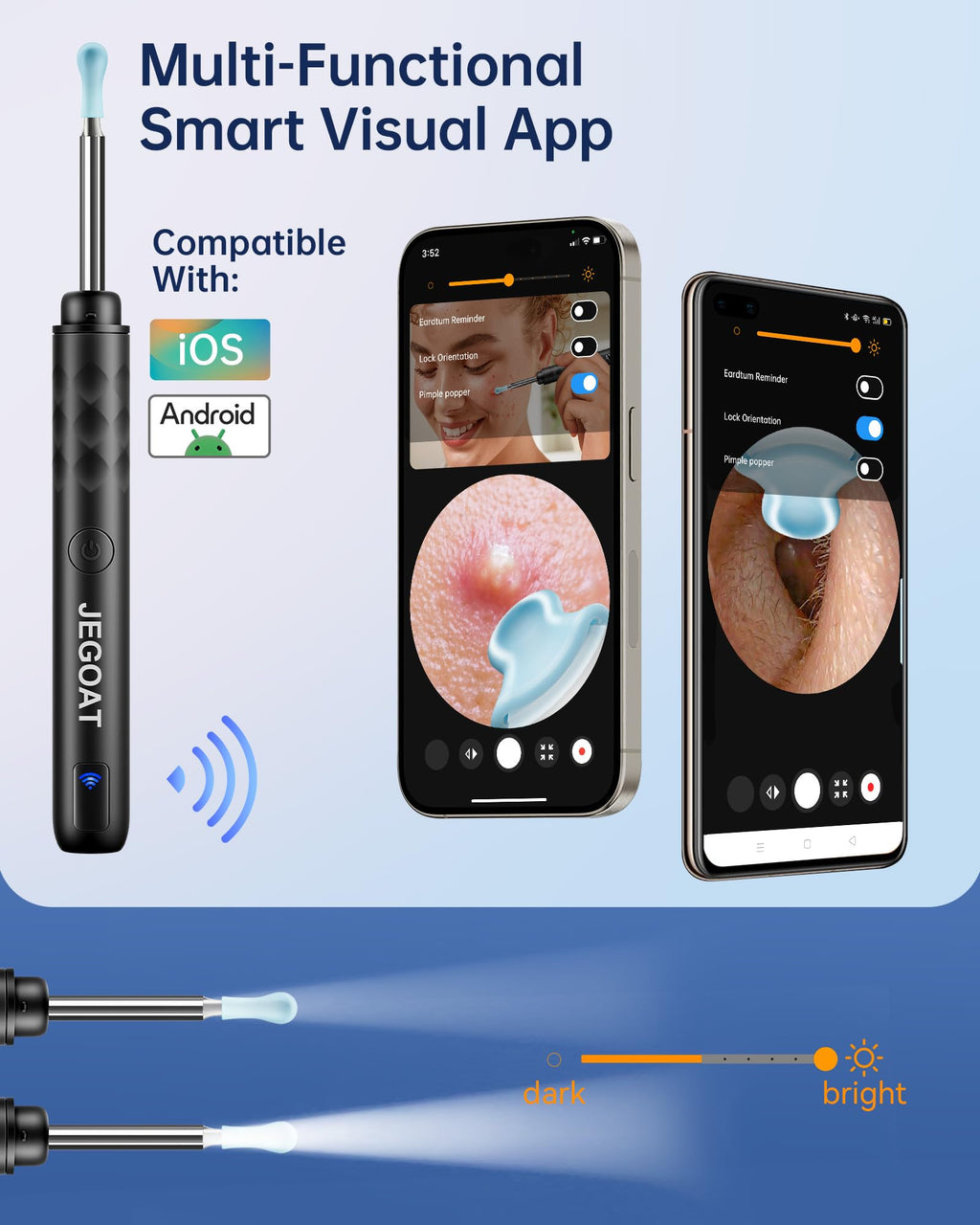 JEGOAT Ear Wax Removal Kit — 1296P HD Camera, 6 LED Lights, 12 Tips, iOS/Android