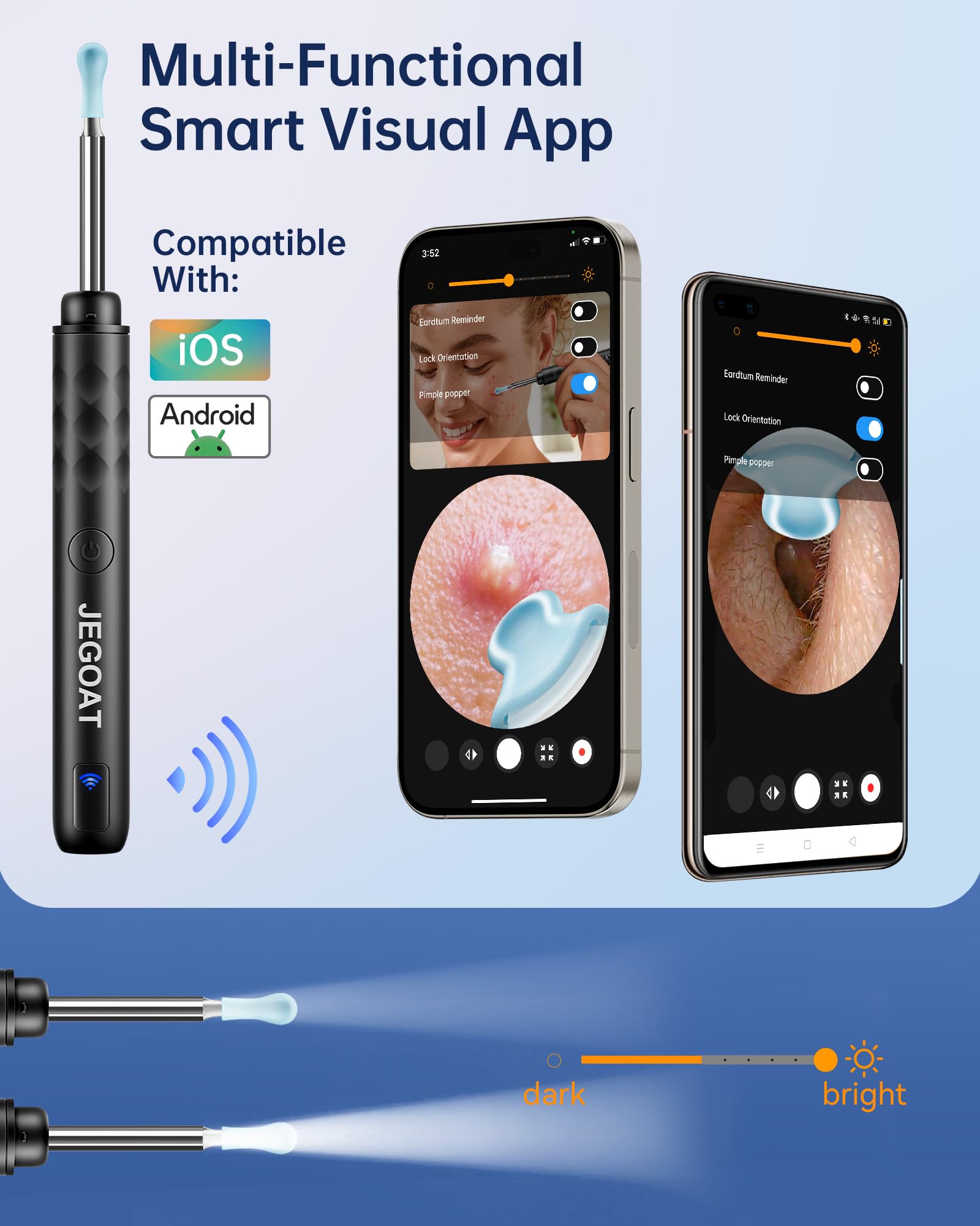 JEGOAT Ear Wax Removal Kit — 1296P HD Camera, 6 LED Lights, 12 Tips, iOS/Android