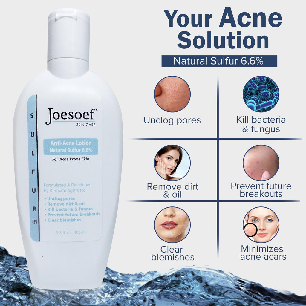 JOESOEF SKIN CARE Sulfur Soap for Acne – Dermatologist-Approved, Pharmaceutical-Grade, Rosacea-Safe (2-Pack)