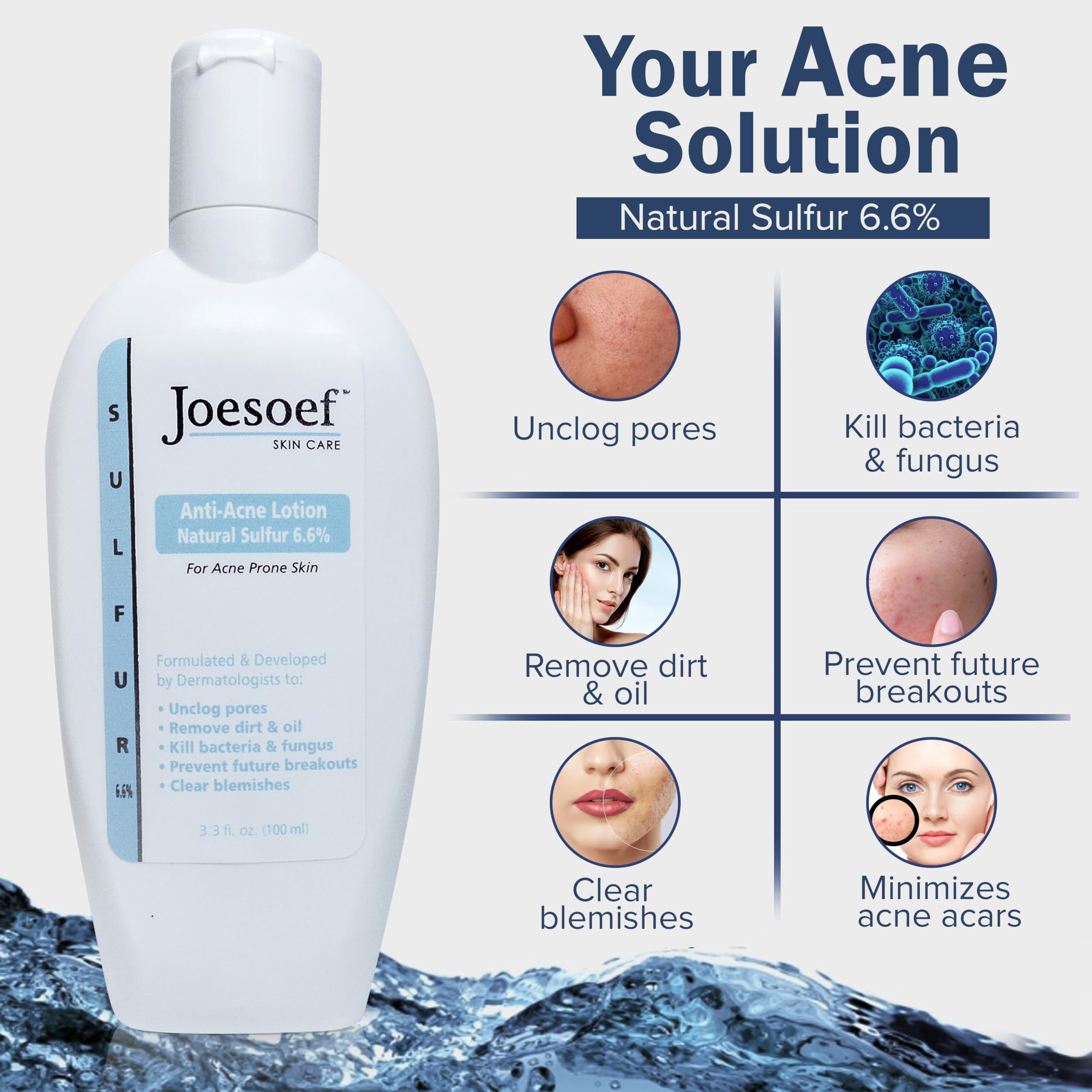 JOESOEF SKIN CARE Sulfur Soap for Acne – Dermatologist-Approved, Pharmaceutical-Grade, Rosacea-Safe (2-Pack)