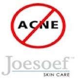 JOESOEF SKIN CARE Sulfur Soap for Acne – Pharmaceutical Grade, Dermatologist Approved 100g