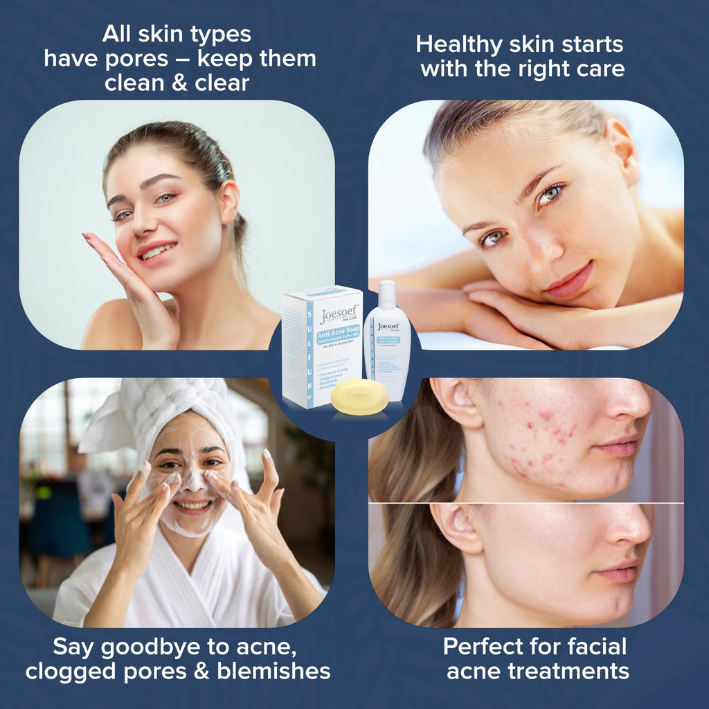 JOESOEF SKIN CARE Sulfur Soap for Acne – Dermatologist-Approved, Pharmaceutical-Grade, Rosacea-Safe (2-Pack)
