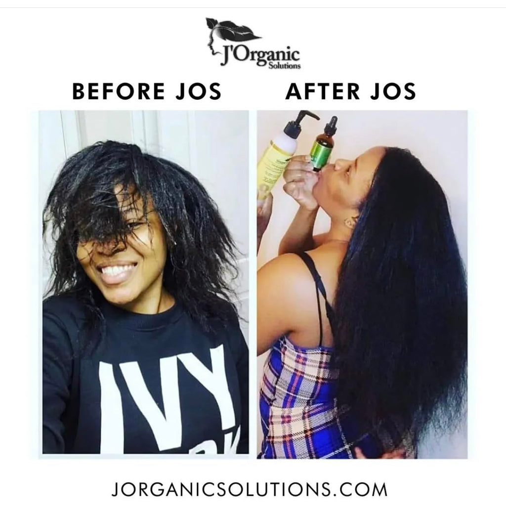 J'Organic Solutions Adult Super Healthy Hair Growth Kit – Growth Moisturizer, Hydrating Shampoo, Argan Oil Hair Mask, Growth-Plus Serum, Moringa-Shea Yogurt