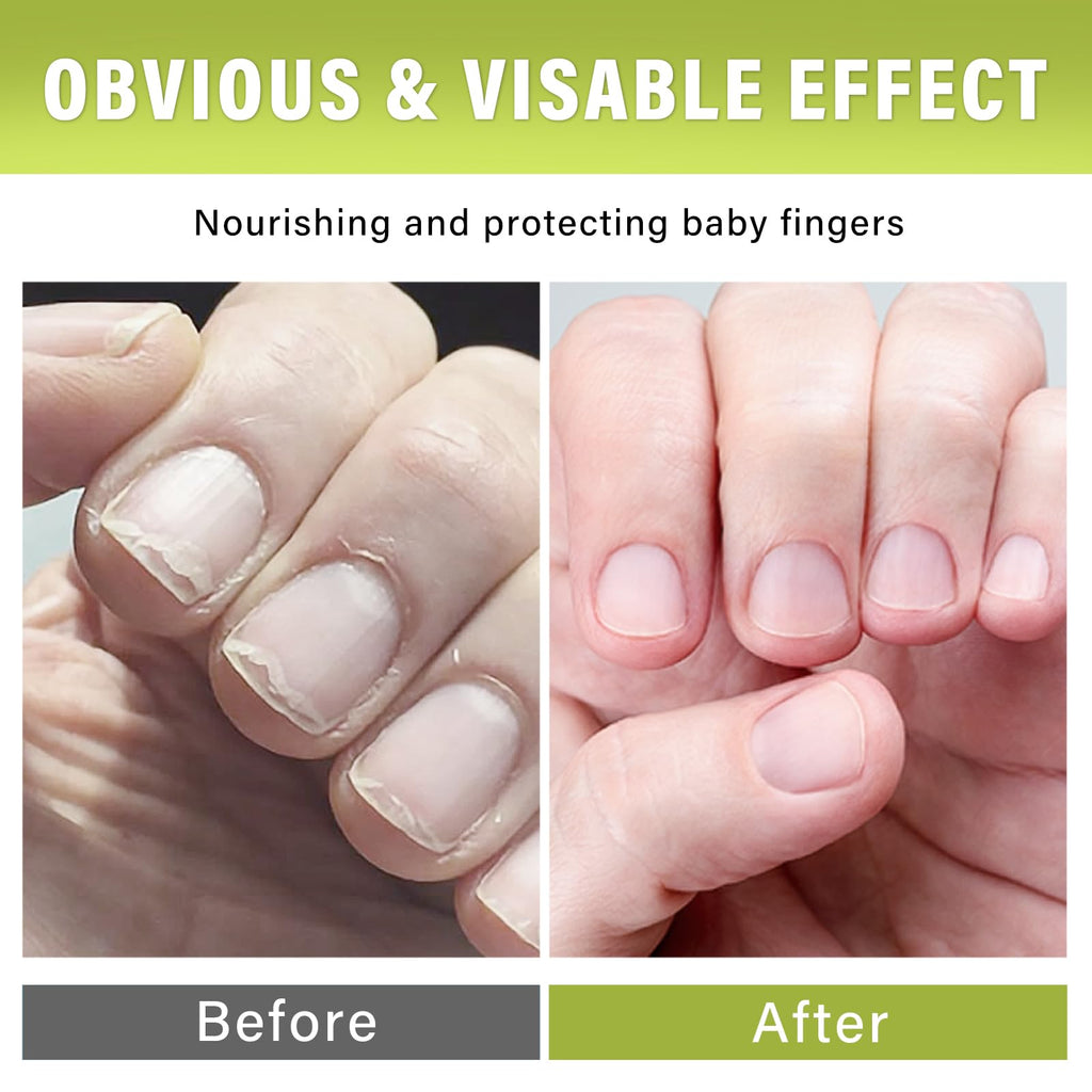 Josera Nail Biting Treatment for Kids – Safe, Natural No-Bite Cream