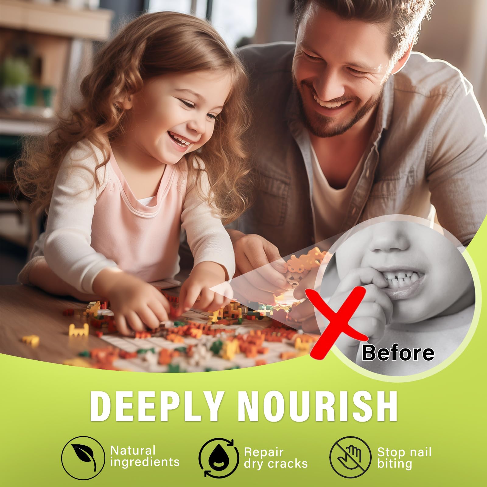 Josera Nail Biting Treatment for Kids – Safe, Natural No-Bite Cream