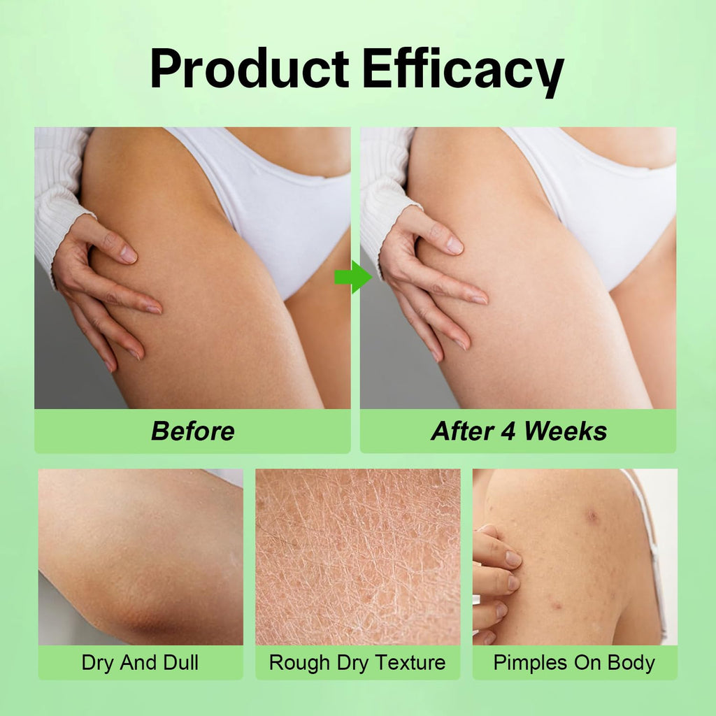 Josmon Magnesium Cream for Neuropathy – Deeply Moisturizing Body Butter, 115 ml