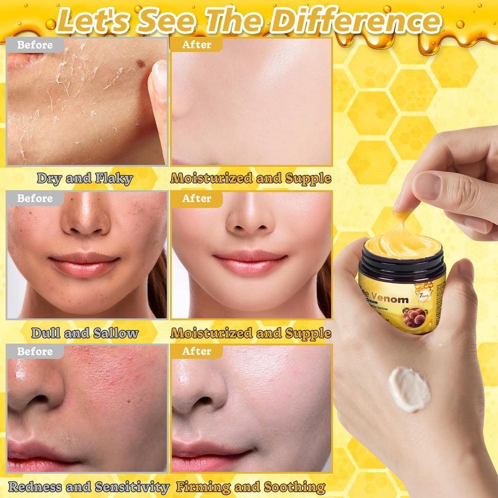 Juanchi Bee Venom Skin Treatment Cream – 2025 Upgrade Pro Repair, Firming Moisturizer for All Skin Types | 2-Piece Set