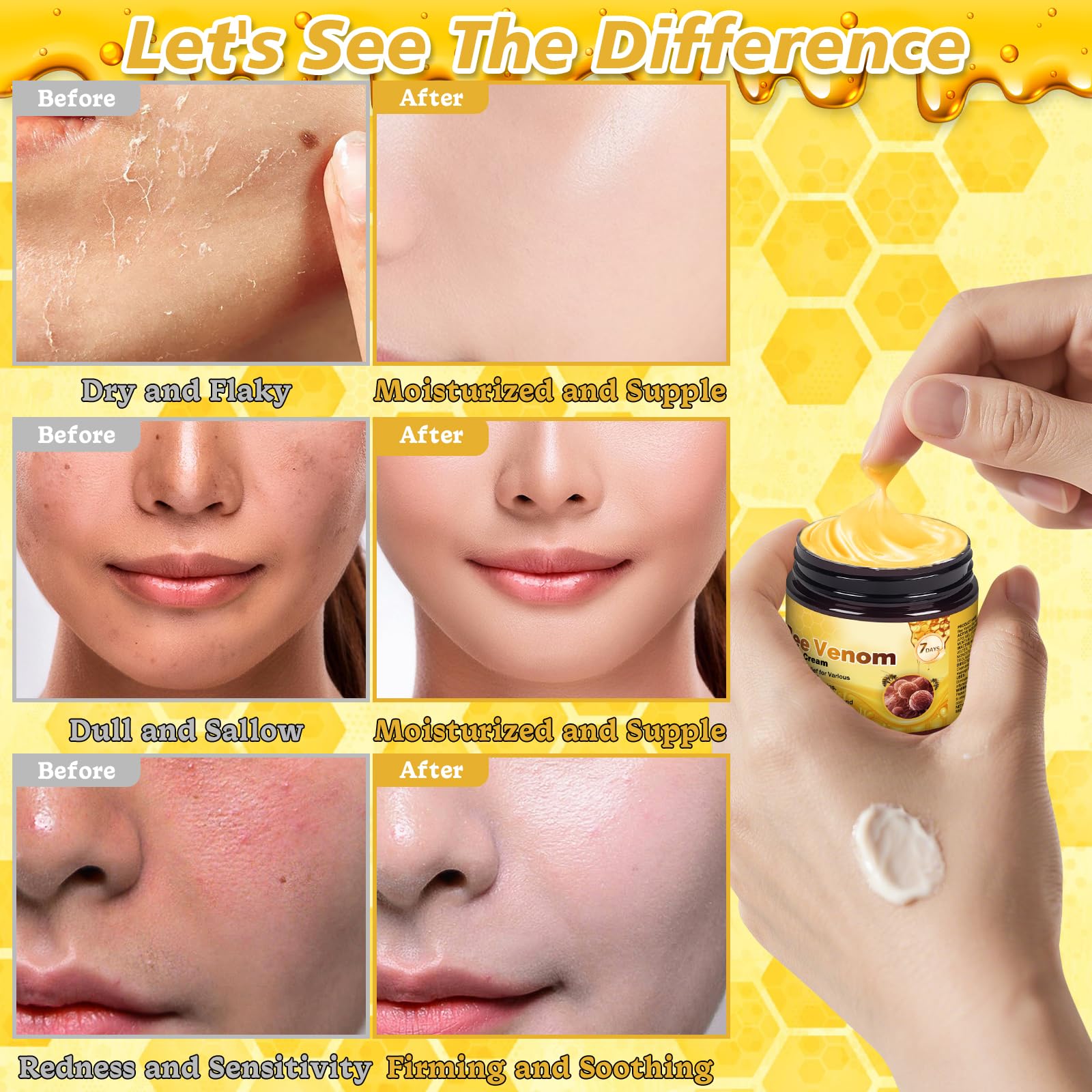 Juanchi Bee Venom Skin Treatment Cream – 2025 Upgrade Pro Repair, Firming Moisturizer for All Skin Types | 2-Piece Set