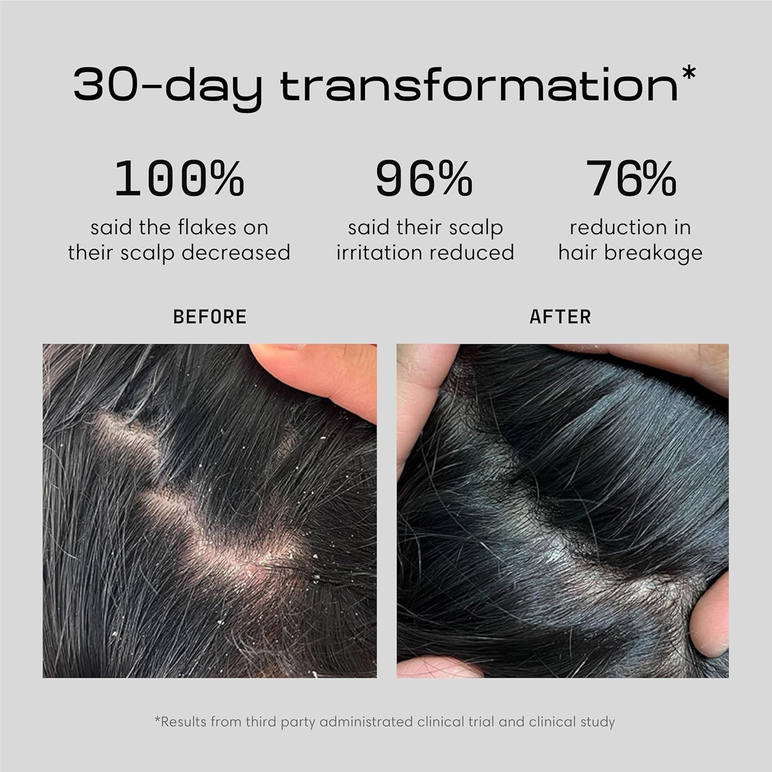 Jupiter Scalp Solution Trio: Anti-Dandruff Shampoo, Conditioner & Serum