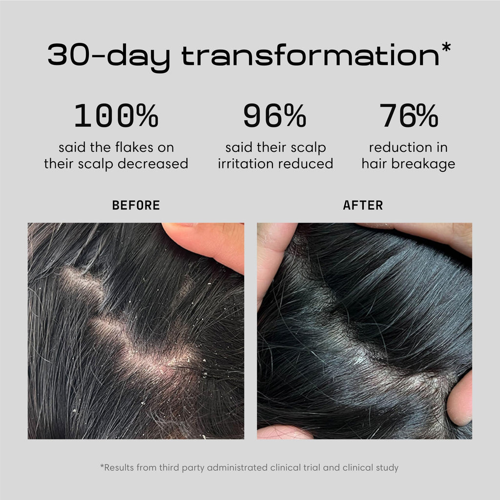 Jupiter Anti Dandruff Shampoo, Conditioner & Scalp Scrubber — Color-Safe, Sulfate-Free