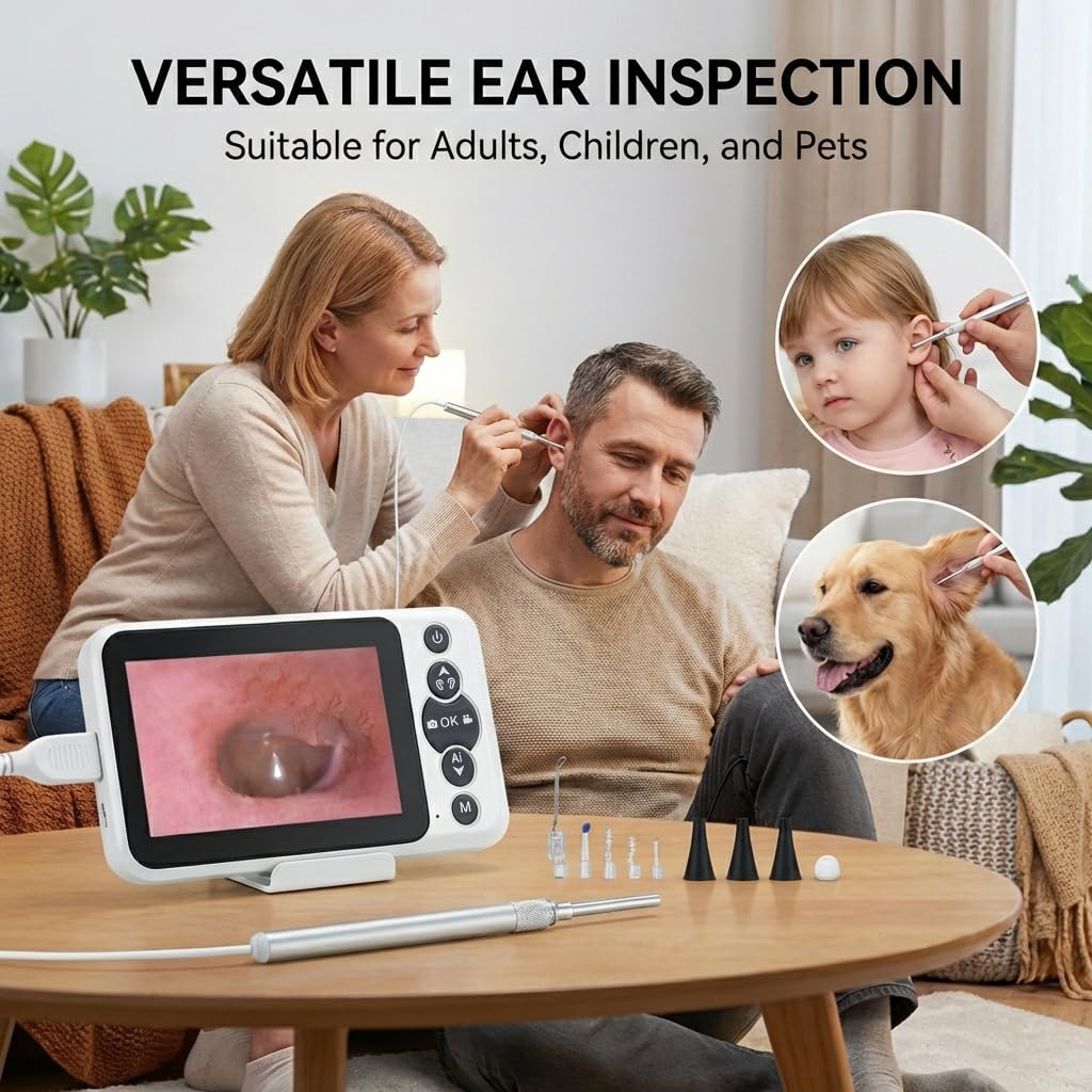 JYTONE Digital Otoscope – 4.5-Inch HD Screen, No App Needed, 3.9mm Probe