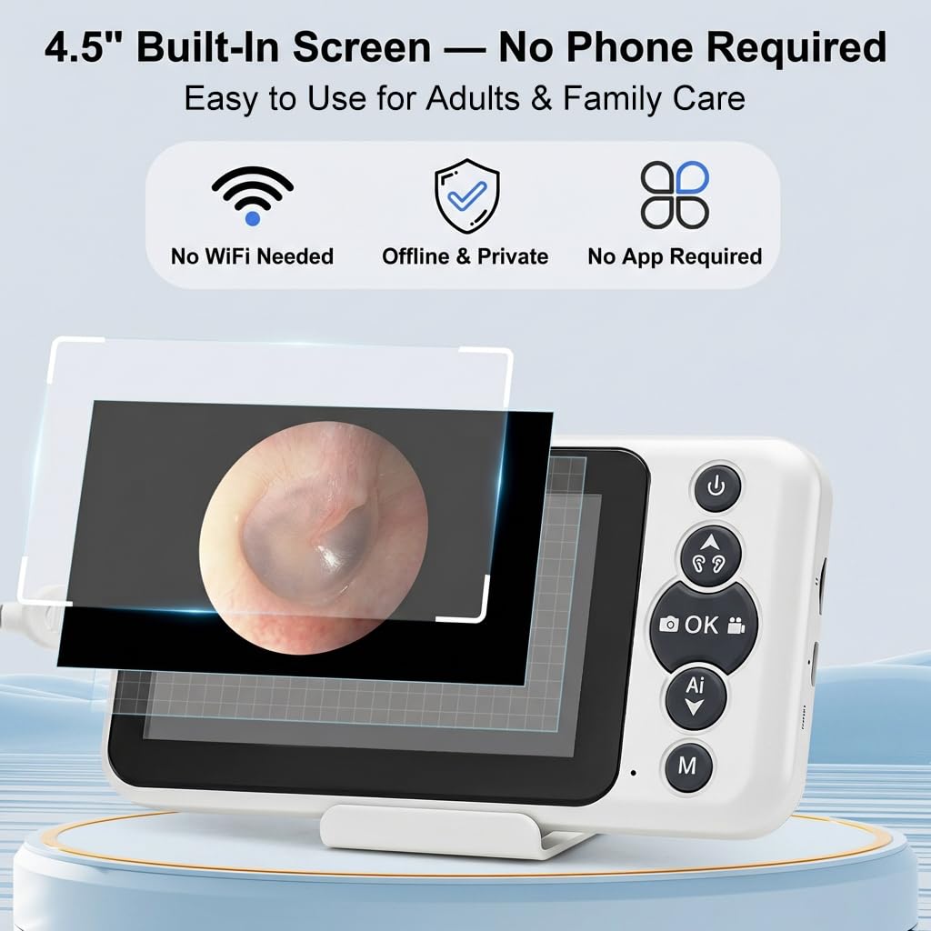 JYTONE Digital Otoscope – 4.5-Inch HD Screen, No App Needed, 3.9mm Probe