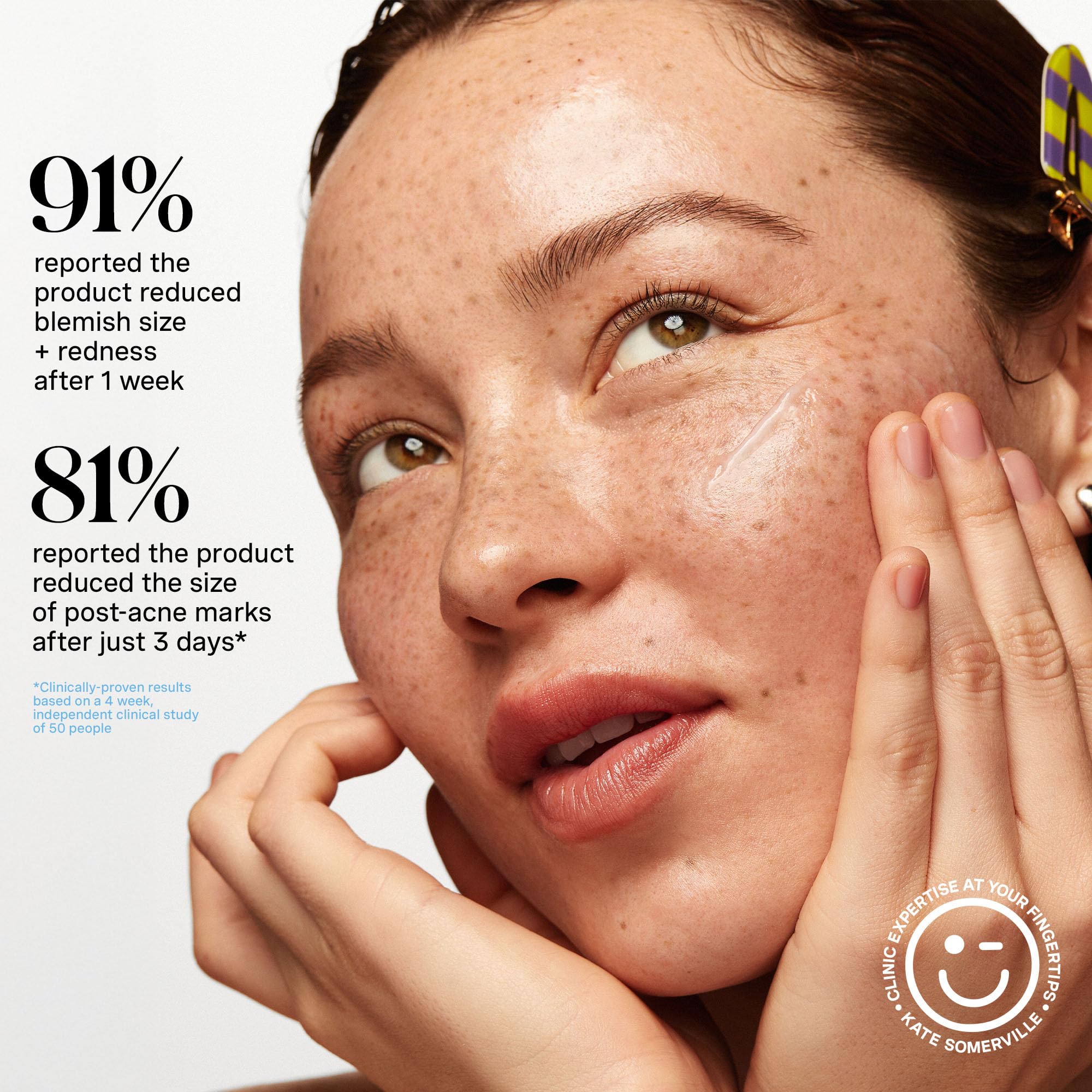 Kate Somerville EradiKate Acne Mark Fading Gel | Salicylic Acid Treatment | 1 oz
