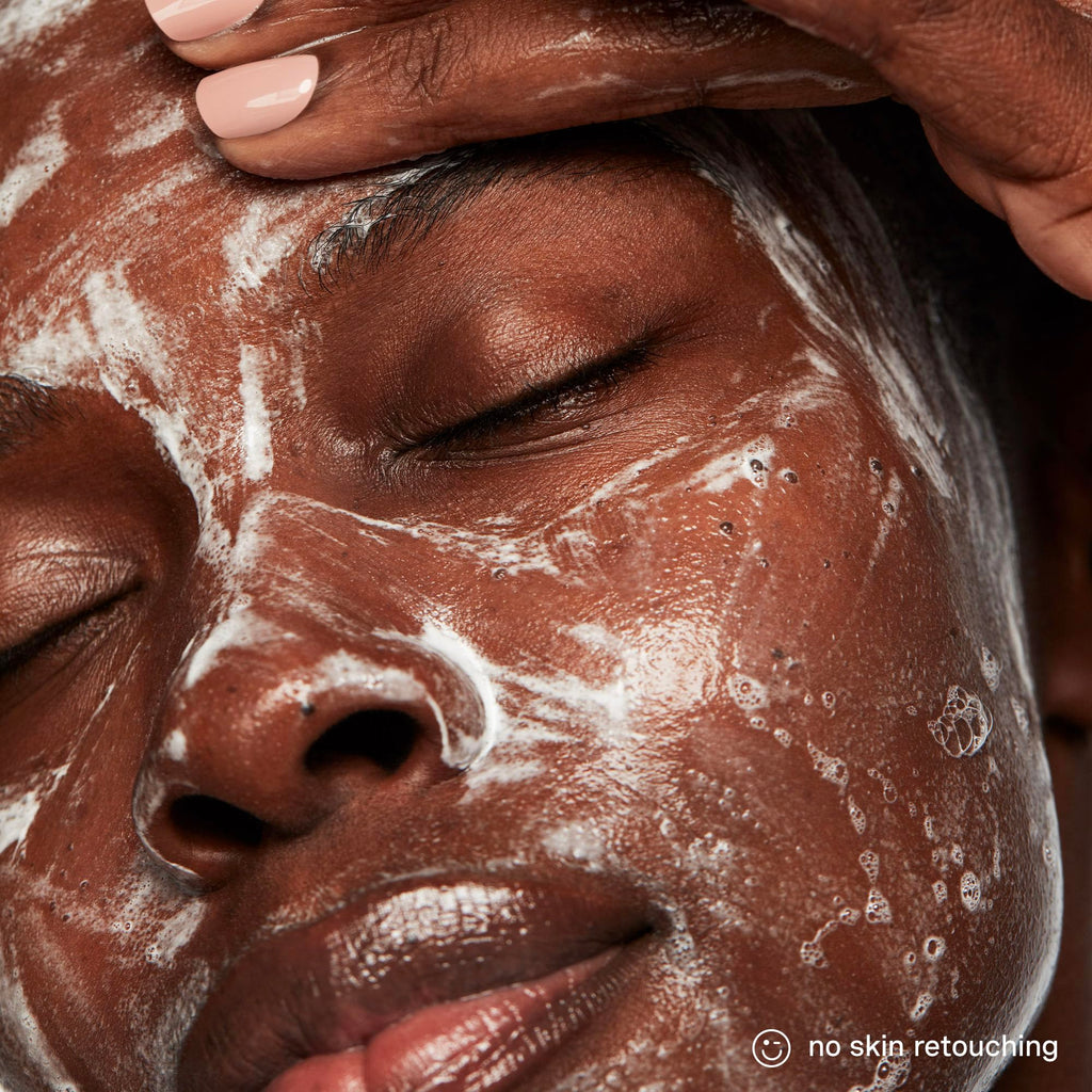Kate Somerville ExfoliKate Cleanser: Daily Exfoliating Foaming Face Wash with Glycolic & Lactic Acids (8 oz)