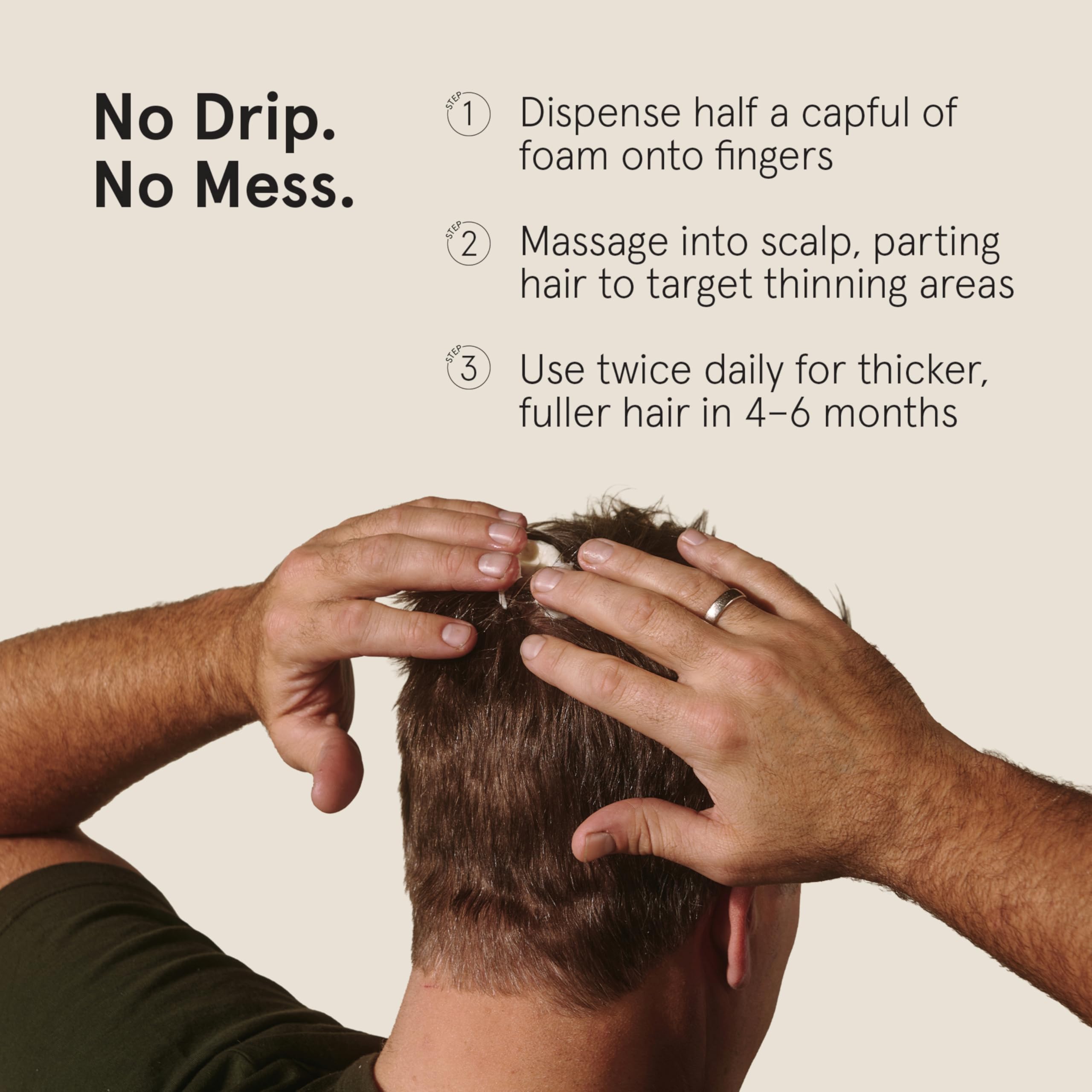 Keeps 5% Minoxidil Foam for Men – 3 Month Supply (3 x 2.11oz), Crown Hair Loss Treatment
