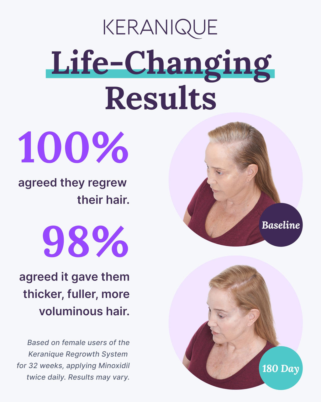 Keranique Hair Growth System for Women – Minoxidil 2% Regrowth + Hydrating Shampoo & Conditioner