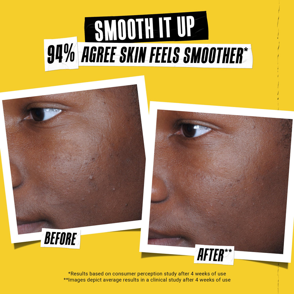 Kiehl's Better Screen UV Serum SPF 50+ — Invisible Facial Sunscreen with Collagen Peptide