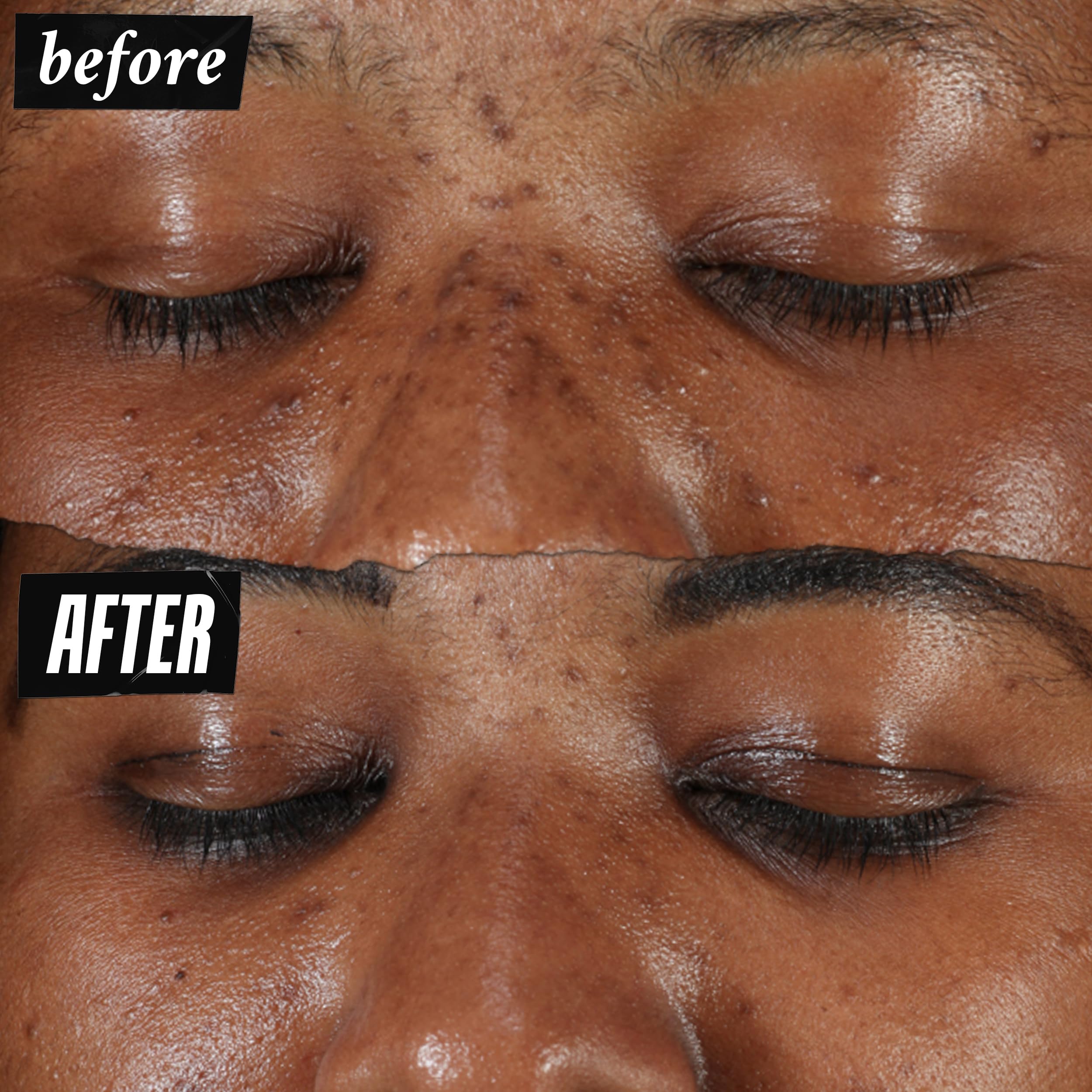 Kiehl's Clearly Corrective Dark Spot Serum | Brightening Facial Serum for Even Skin Tone