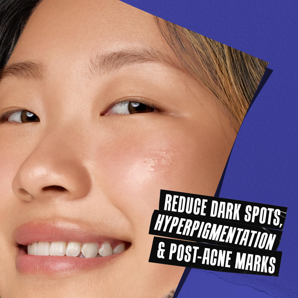 Kiehl's Clearly Corrective Dark Spot Serum | Brightening Facial Serum for Even Skin Tone