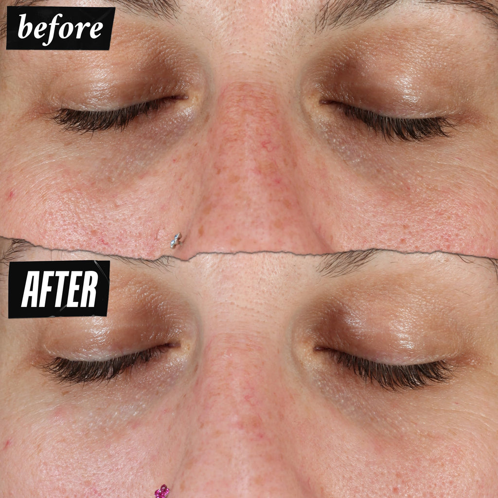 Kiehl's Clearly Corrective Dark Spot Serum | Brightening Facial Serum for Even Skin Tone