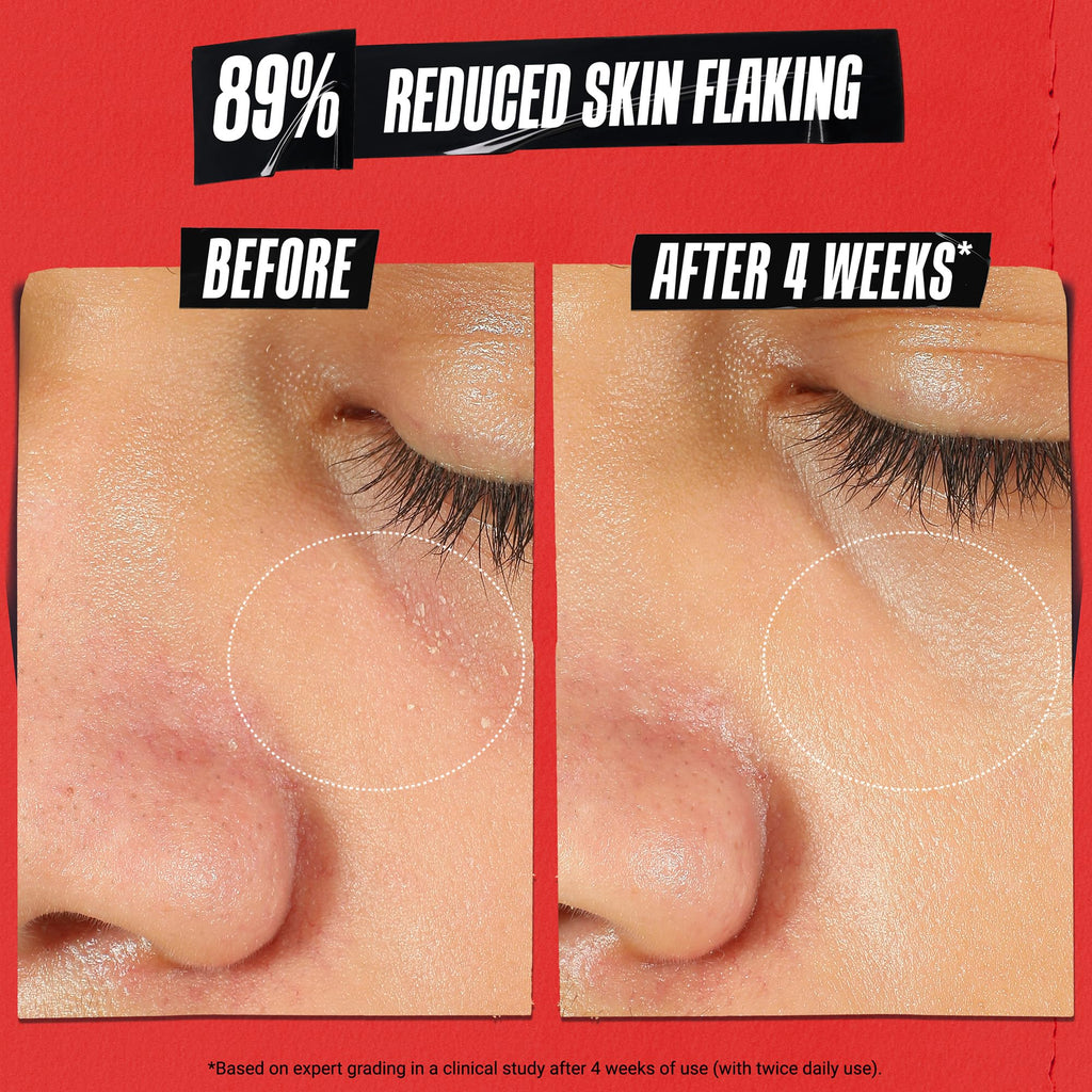 Kiehl's Ultra Facial Recovery Barrier Cream – Lightweight Moisturizing Face Cream for Dry & Sensitive Skin (1.7 fl oz)
