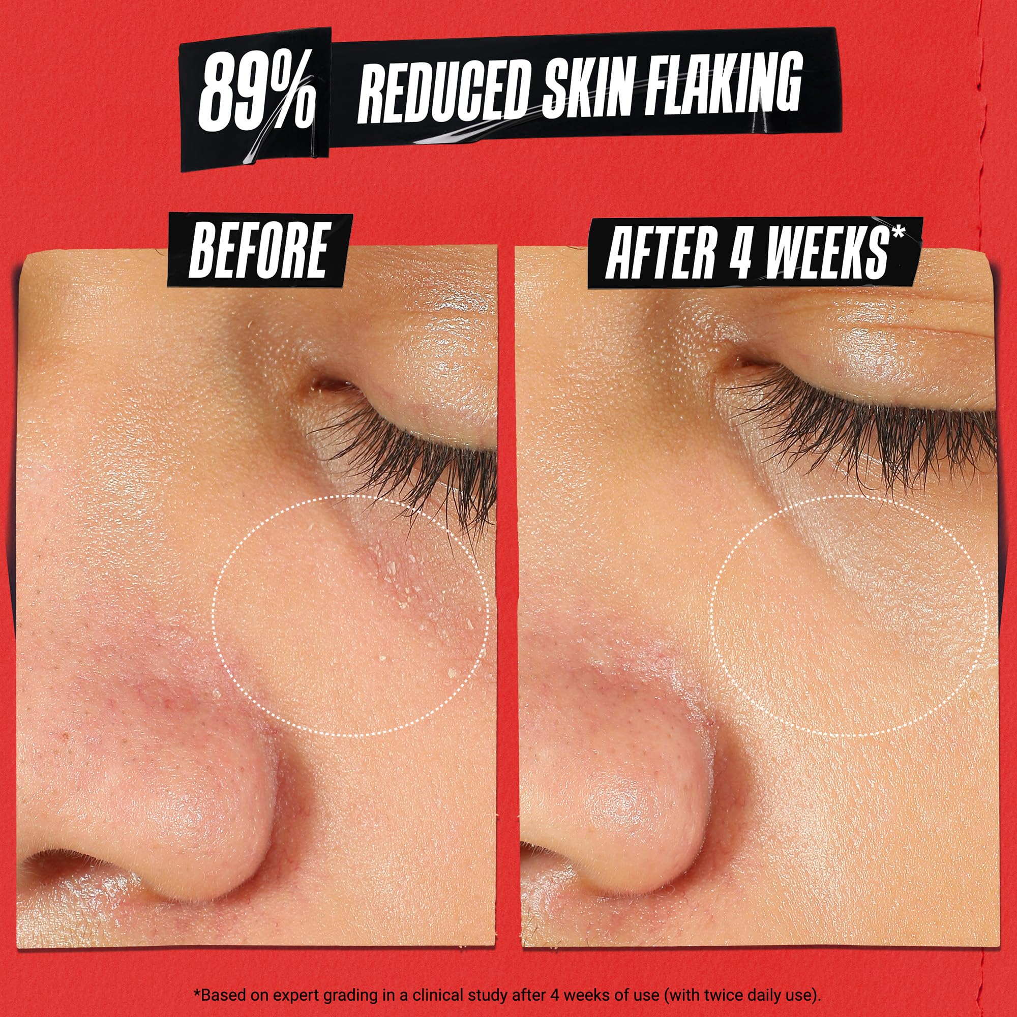 Kiehl's Ultra Facial Recovery Barrier Cream – Lightweight Moisturizing Face Cream for Dry & Sensitive Skin (1.7 fl oz)