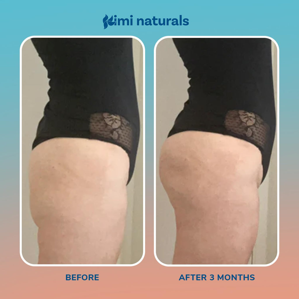 KIMI Naturals Curvy Peaches Butt Enhancement Cream – Fast Growth & Firming (4 oz)