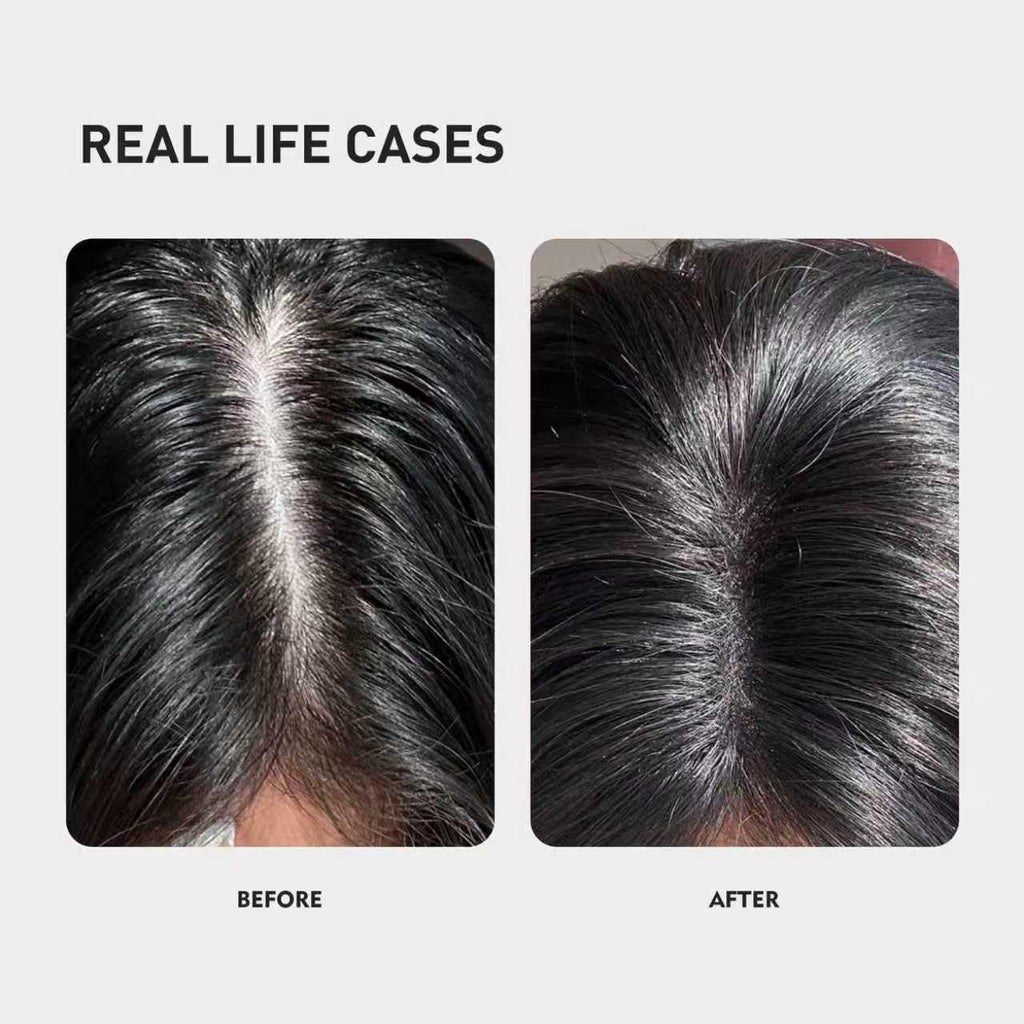 KINTOR 0.5% KX-826 DHT Blocker Hair Thickening Spray | Plant-Based Growth Solution