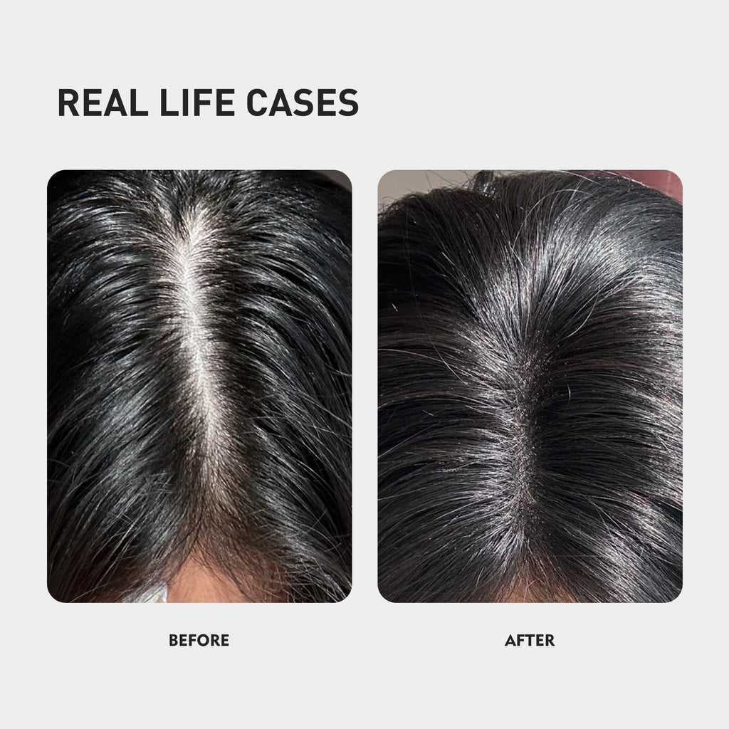 KINTOR 0.5% KX-826 Hair Growth Spray – DHT Blocker for Thicker Hair (60ml)