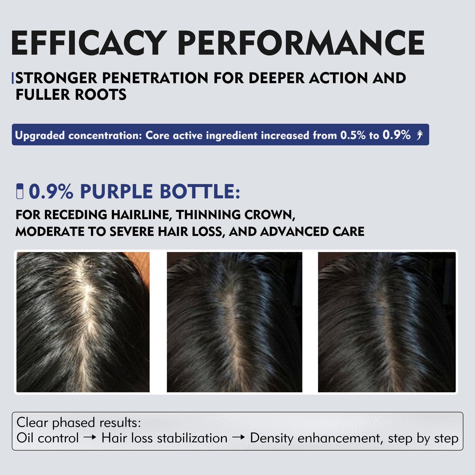 KINTOR 0.9% KX-826 DHT Blocker for Men & Women – Hair Growth Spray 60ml Pro