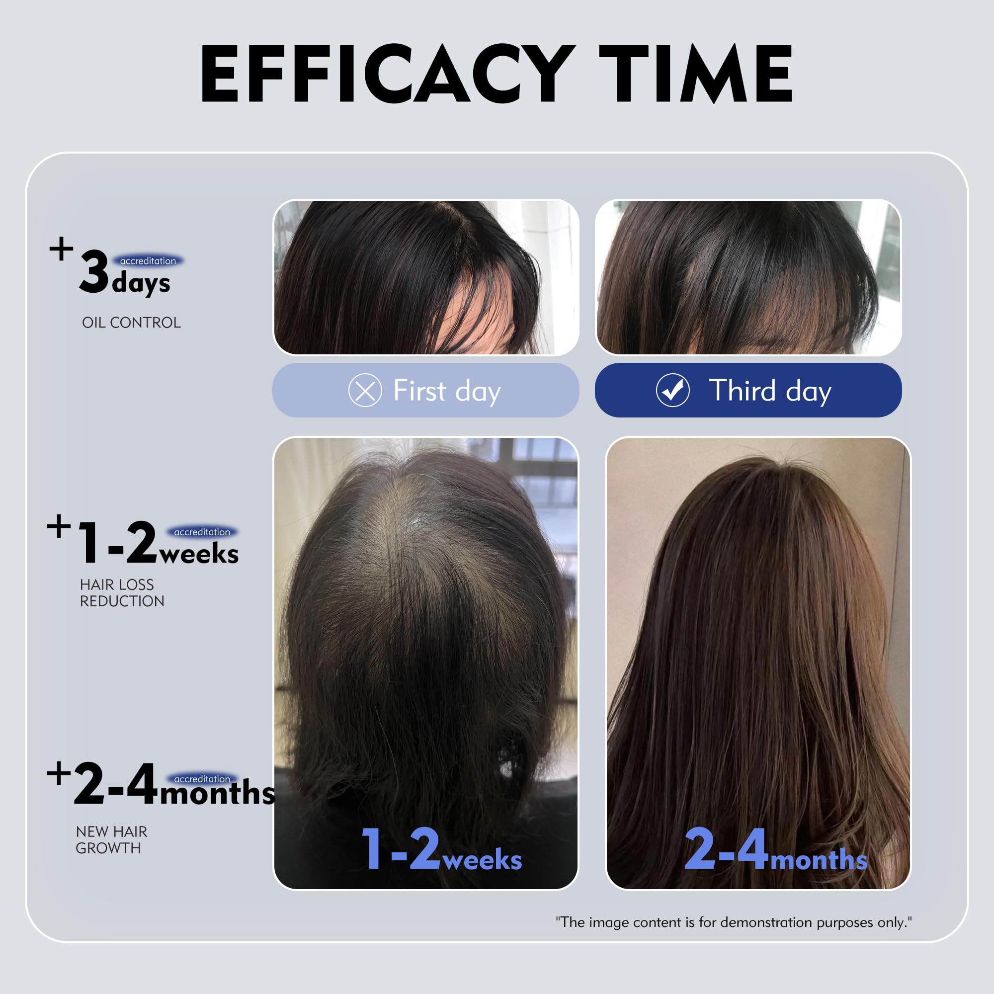 KINTOR 0.9% KX-826 DHT Blocker for Men & Women – Hair Growth Spray 60ml Pro