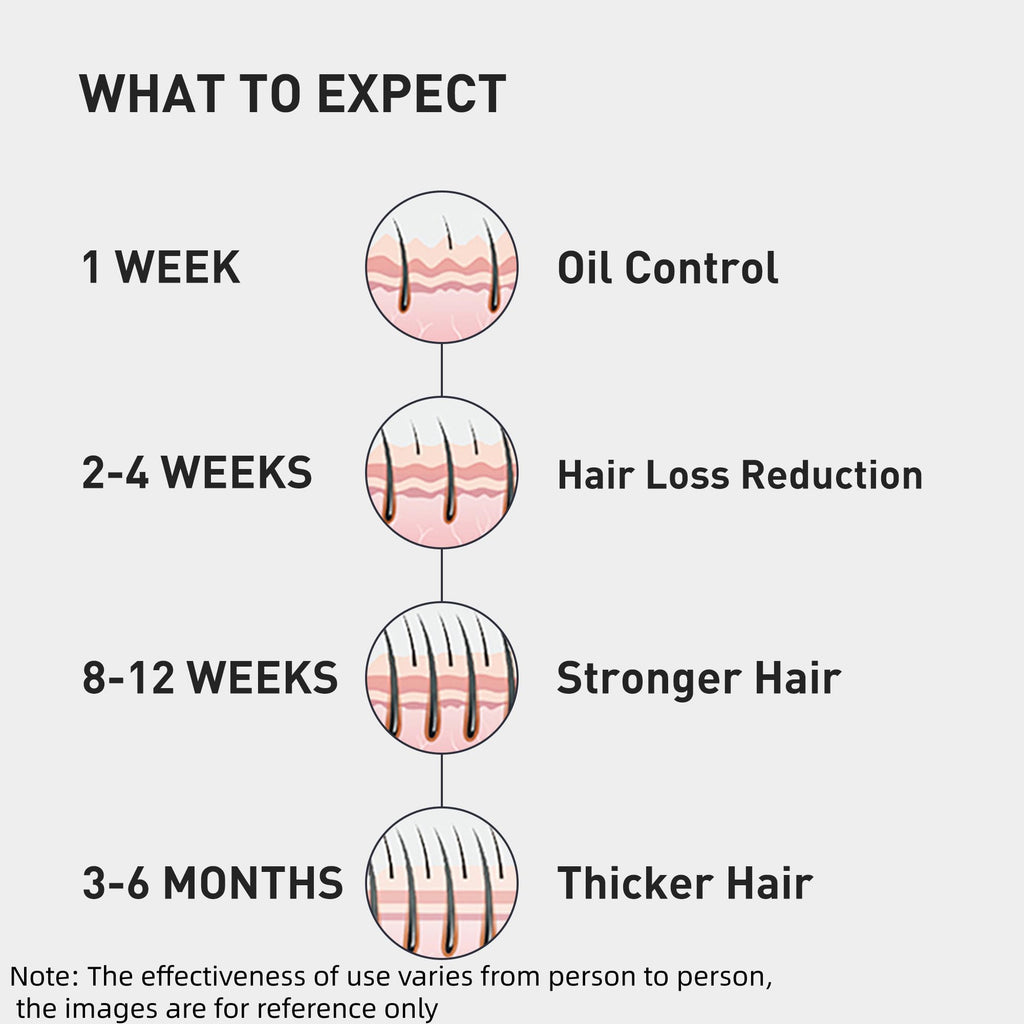 KINTOR 0.9% KX-826 Hair Regrowth Spray – Supports Healthy Hair Growth & Oil Control | 60ml