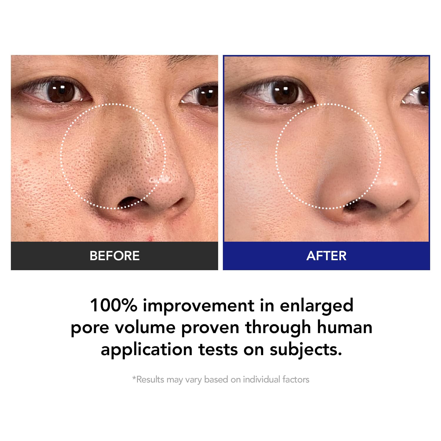 KIOSKIN Toner Pads – 35% Smaller Pores, 32% Reduced Pore Area, CICA Exosomes, AHA/BHA/PHA