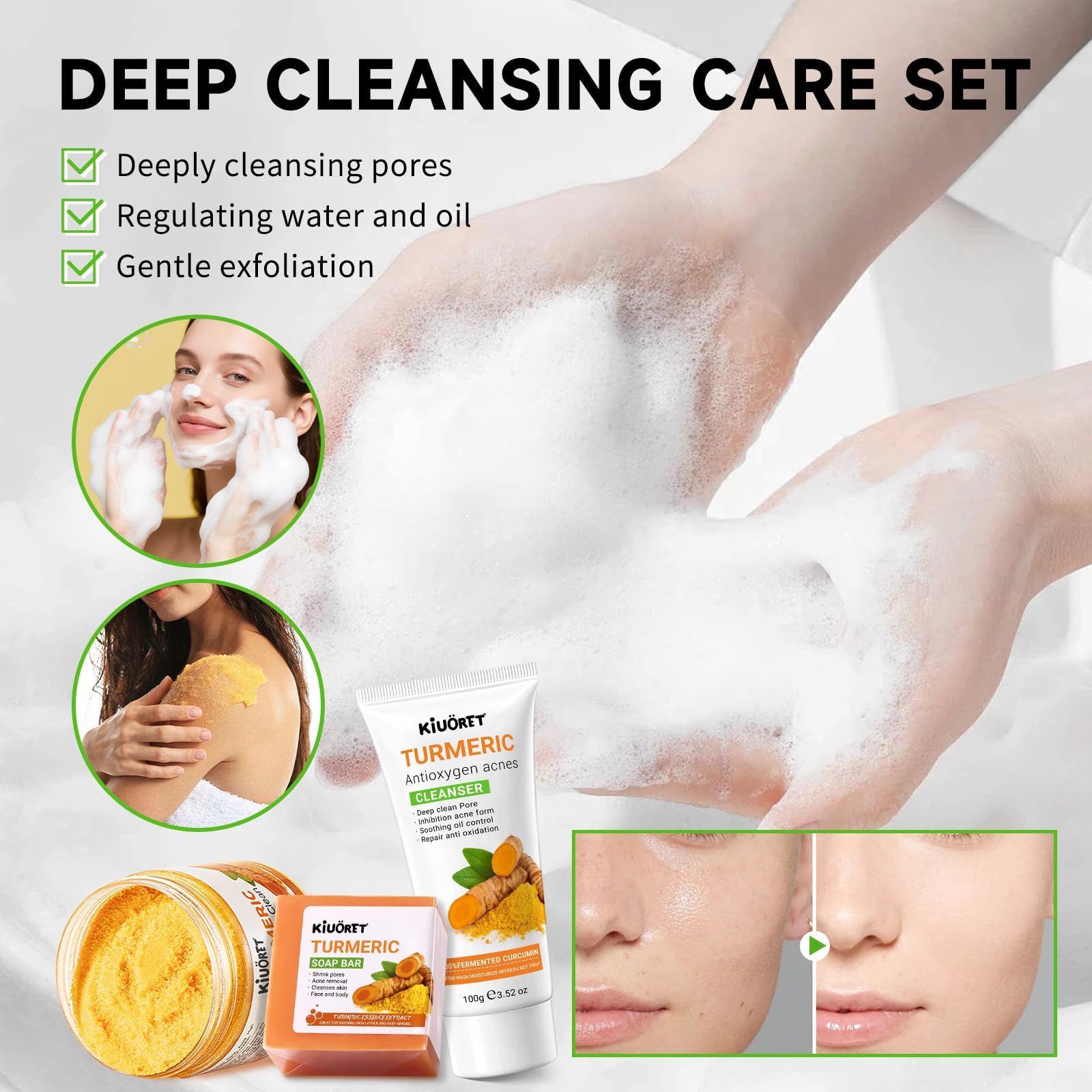 KIUORET Turmeric 11-Piece Skin Care Set | Hydration & Acne Support
