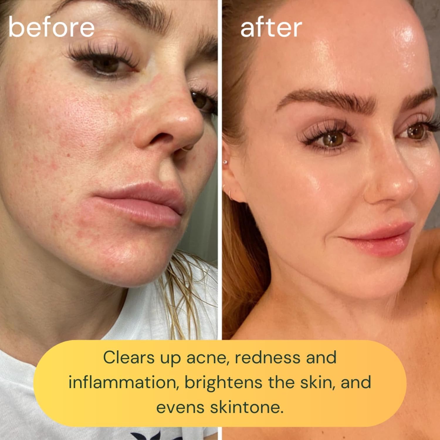KOA LIFE Vit-C Brightening Facial Cleanser XL | Vitamin C Foam Cleanser (Vegan)
