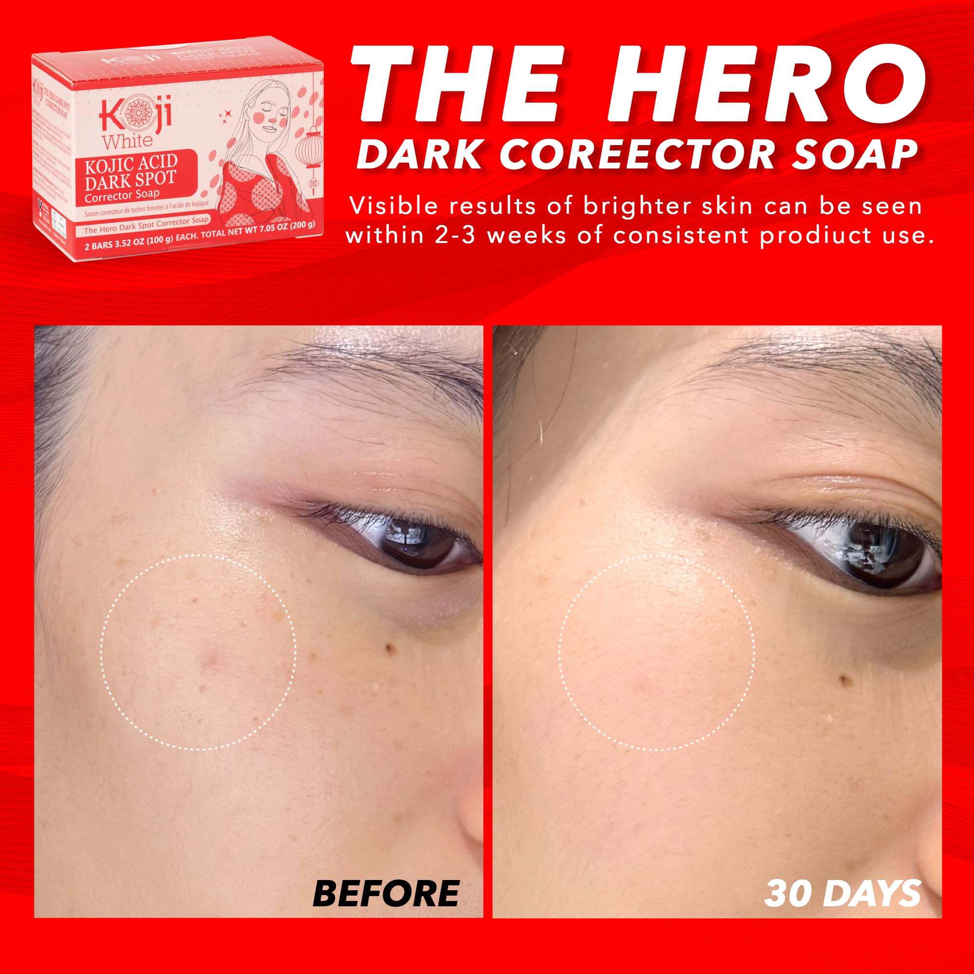 Koji White 4% Kojic Acid Dark Spot Corrector Soap – Vitamin C & Licorice Bar