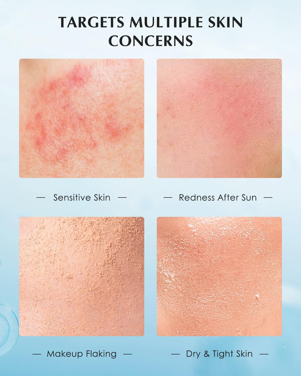 KOMFYMED Recombinant Collagen Restoration One-Day Serum – 4 Collagen Types, Ectoin, Hydration, 30 Single-Use Vials